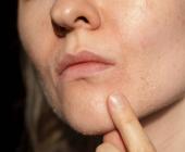 Dùng Retinol có nhất định phải bong da? Cách sử dụng Retinol hiệu quả cho làn da