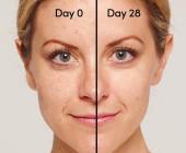 Retinol nên kết hợp với những hoạt chất nào? 