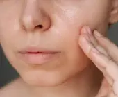 Tại sao skincare đúng cách nhưng da vẫn đổ dầu nhiều? 