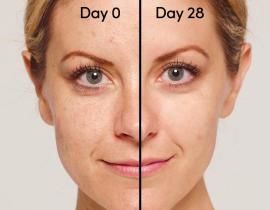 Retinol nên kết hợp với những hoạt chất nào? 