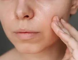 Tại sao skincare đúng cách nhưng da vẫn đổ dầu nhiều? 