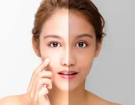 Tips dưỡng trắng da vào mùa đông giúp da sáng khỏe và mịn màng