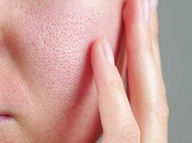 Các hoạt chất cải thiện lỗ chân lông to và lưu ý khi sử dụng