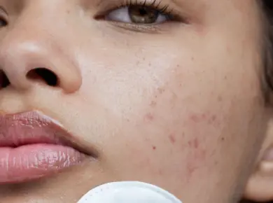 Hướng dẫn cách lựa chọn treatment cho da nhạy cảm