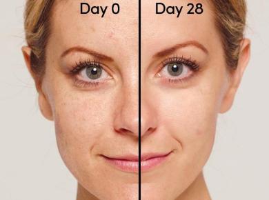 Retinol nên kết hợp với những hoạt chất nào? 