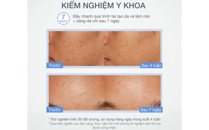Bột tẩy tế bào chết làm sáng da Dermalogica Daily Microfoliant 13g