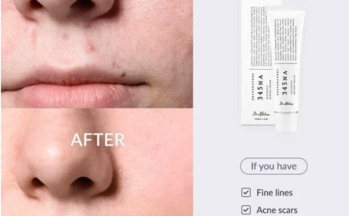 Kem dưỡng sáng và phục hồi da Dr.Althea 345 Relief Cream 50ml