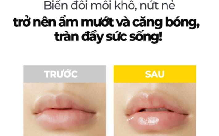 Son dưỡng môi keo ong đa năng (Lipcerin) phục hồi và giữ ẩm môi kéo dài đến 12 giờ CNP Laboratory Propolis Lipcerin 15ml