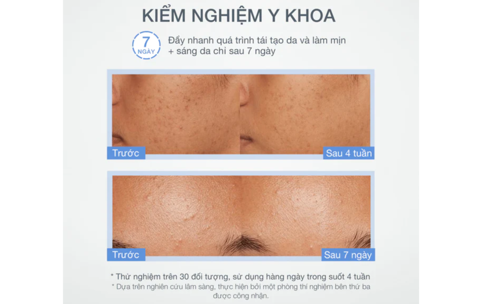 Bột tẩy tế bào chết làm sáng da Dermalogica Daily Microfoliant 13g