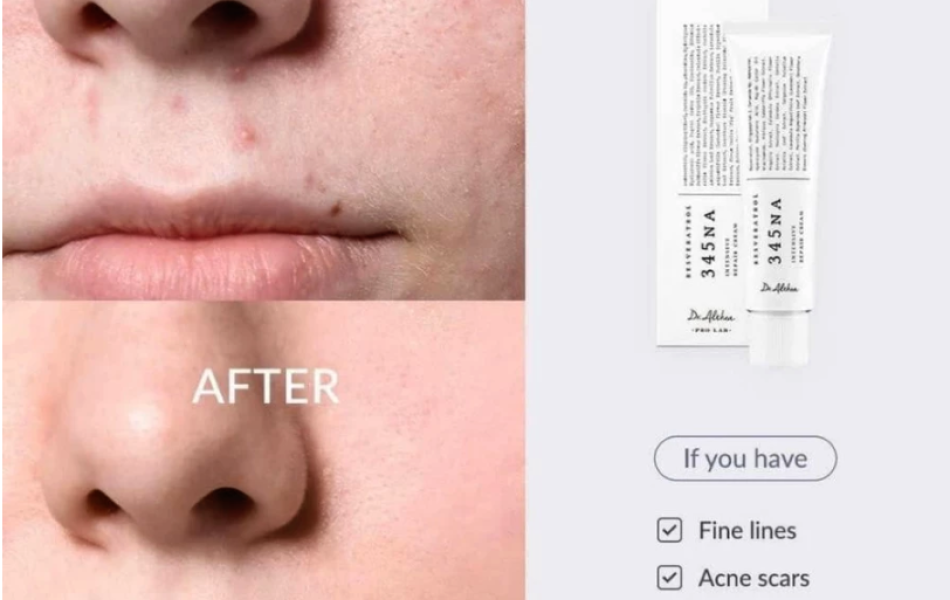 Kem dưỡng sáng và phục hồi da Dr.Althea 345 Relief Cream 50ml
